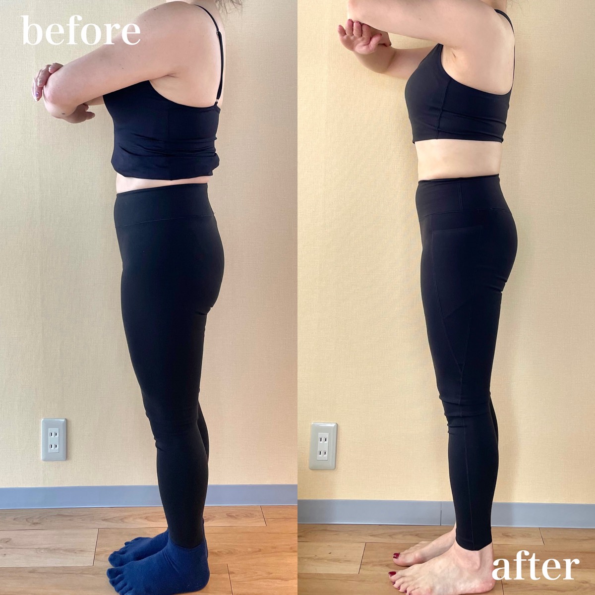 ④ギュッと全身詰まりタイプのビフォーアフター