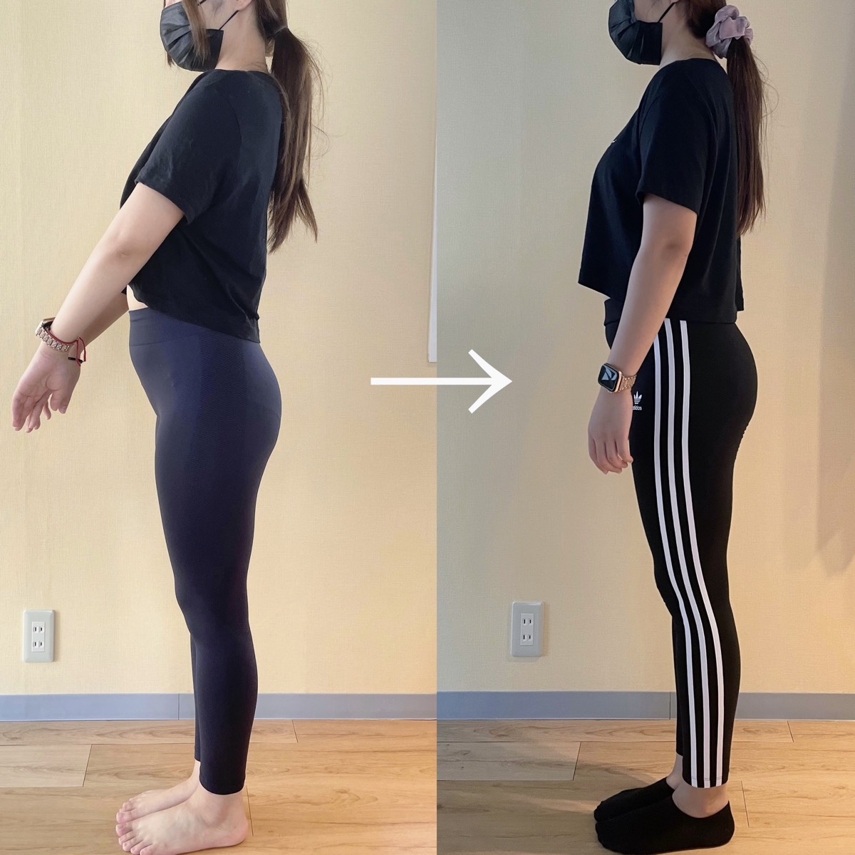 ②グニッと上半身ズレタイプのビフォーアフター